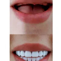 دندانسازی ایده آل|خدمات آرایشگری و زیبایی|لاهیجان, گلستان|دیوار
