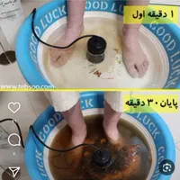 دفع سموم کل بدن از کف پا یون تراپی