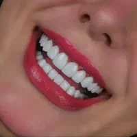 ایمپلنت روکش کامپوزیت ارتودنسی دندانپزشکی