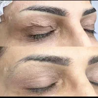 لیفت و جوانسازی پلک بدون جراحی با تخفیف ۵۰ درصد|خدمات آرایشگری و زیبایی|اصفهان, مرداویج|دیوار