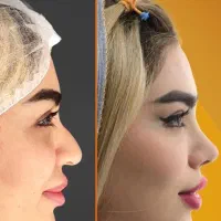 فرصت محدود فقط تا اخر هفته