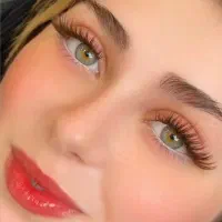 کاشت مژه 200 و موخوره گیری 160