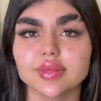 تزریق ژل بوتاکس و چربی شکم پهلو|خدمات آرایشگری و زیبایی|کرمانشاه, |دیوار