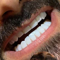 ،دندون پزسکی کامپوزیت دندان فکی ۸ میلیون|خدمات آرایشگری و زیبایی|اسلام‌شهر, شهرک مفیدی|دیوار