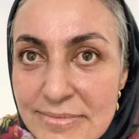 فروش کرم های ضد لک|آرایشی، بهداشتی، درمانی|قائمشهر, |دیوار