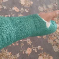 امپول، سرم وسوند،تزریقات،اکسیژن، پرستار سامیار طب|خدمات زیبایی و سلامت|کرمانشاه, |دیوار