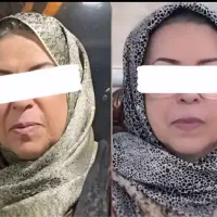 کرم ضدلک و سفیدکننده قوی و‌جوانساز صورت|آرایشی، بهداشتی، درمانی|فردیس, مجموعه کارخانه جات مپنا|دیوار