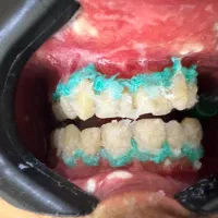 انجام خدمات دندانپزشکی زیبایی و درمانی|خدمات آرایشگری و زیبایی|ساری, |دیوار