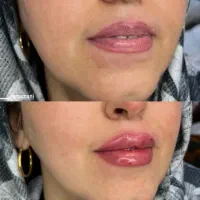 خدمات ژل و بوتاکس هر سی سی ژل ۴۸۰|خدمات آرایشگری و زیبایی|اهواز, حصیرآباد|دیوار