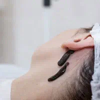 حجامت . زالو. کاپینگ تراپی