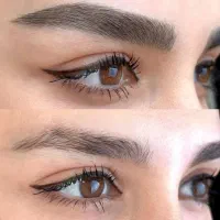 میکرو بلیدینگ ،فیبروز