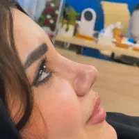 جشنواره جراحی بینی