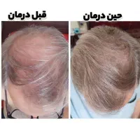 سی روزه کچلی رو ببوس خدافظی کن
