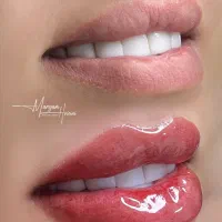 آموزش تخصصی میکرو ( آرایش دائم) با شرایط ویژه