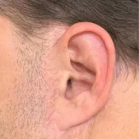 کاموفلاژ مدل رایگان درمان ترک پوستی و تیرگی بدن