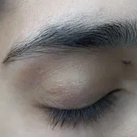 خدمات تخصصی لیفت و لمینت