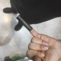 انگشت مصنوعی درمانی