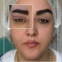 تخفیف خدمات ژل/بوتاکس/جوانساز توسط پزشک|خدمات زیبایی و سلامت|اهواز, زیتون کارمندی|دیوار