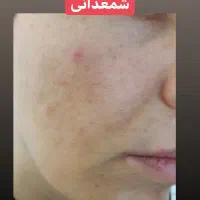 زیبا شو|آرایشی، بهداشتی، درمانی|ایلام, |دیوار