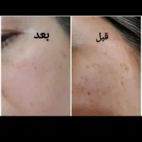 اموزش پلکسر|خدمات آموزشی|بهارستان, |دیوار