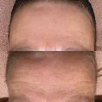 کرم پاورلیفتینگ (ماساژوردار)وسرم بوتاکس|آرایشی، بهداشتی، درمانی|کرمان, |دیوار