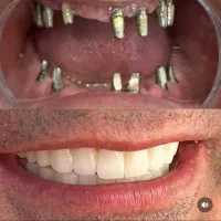 مرکز تخصصی دندانپزشکی ایمپلنت شرایط ویژه اقساطی|خدمات آرایشگری و زیبایی|تبریز, |دیوار