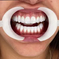 کامپوزیت، لمینت، ایمپلنت دندان اقسا*طی|خدمات آرایشگری و زیبایی|مشهد, شریف|دیوار