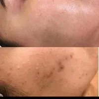 آموزش انلاین پلکسر