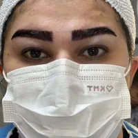 کاشت موی تخصصی تبریز|خدمات آرایشگری و زیبایی|اردبیل, |دیوار