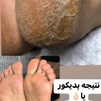 پدیکور پا ،رفع تیرگی ،قوزک پا|خدمات آرایشگری و زیبایی|پاکدشت, پاکدشت (مامازند)|دیوار