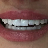 دندان پزشکی