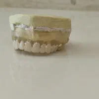 دندان ساز تجربی صدف با بیش از پانزده سال سابقه|آرایشی، بهداشتی، درمانی|سریش آباد, |دیوار