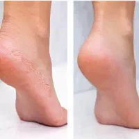 تخفیف ۳۰ درصدی پدیکور و مانیکور و پارافین تراپی|خدمات آرایشگری و زیبایی|کاشان, کشاورز|دیوار