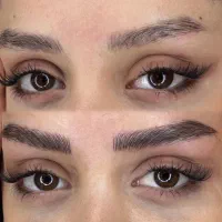 میکروبلیدینگ سوپرنچرال با شرایط ویژه