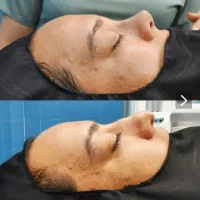 دکتر متخصص عمل بینی