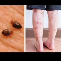 شرکت سمپاشی ساس موریانه موش کک باضمانت کاری|خدمات نظافت|آبادان, |دیوار