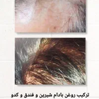 ریزش مومجدد