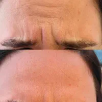 خدمات تخصصی پوست و مو با تخفیفات