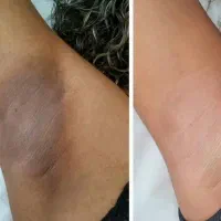 پاسخگوی مشکلات پوستی