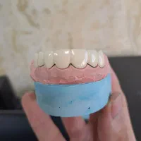 عصبکشی پر کردن ۱۳۰۰ روکش فروش رادیوگرافی|خدمات آرایشگری و زیبایی|مرند, |دیوار