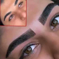 فیبروز،میکرو،آموزش،وریمو تتو درمطب بانوان،آقایان