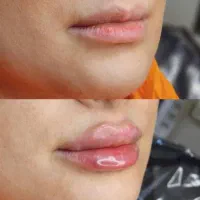 مرکز ‌پزشکی زیبایی در صومعه سرا