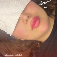 جشنواره یلدایی تزریق باسن وبیکینی ‌و صورت درکلینیک