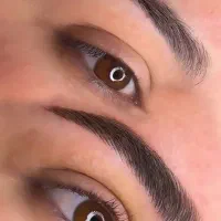 میکروبلیدینگ کرکی مویی