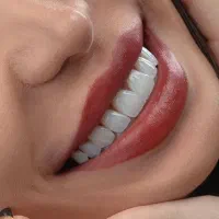 شرایط استثنایی ویژه ایمپلنت،اوردنچر،دندان مصنوعی|خدمات آرایشگری و زیبایی|تهران, مجیدیه|دیوار