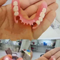 دندان مصنوعی  ( تمام چک )|آرایشی، بهداشتی، درمانی|پارس‌آباد, |دیوار