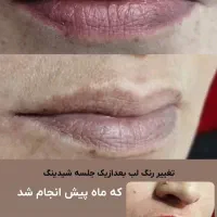آرایش دائم|خدمات آرایشگری و زیبایی|گنبد کاووس, |دیوار