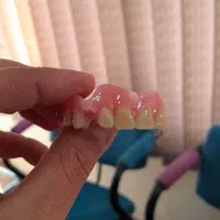 دندانسازی ، دندان مصنوعی|پزشکی|اصفهان, شاهد|دیوار