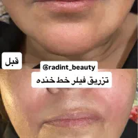 خدمات زیبایی|خدمات آرایشگری و زیبایی|خرمشهر, |دیوار