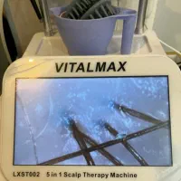 اسکالپ اسکراپ سر  و آنالیز مو ۵۰۰